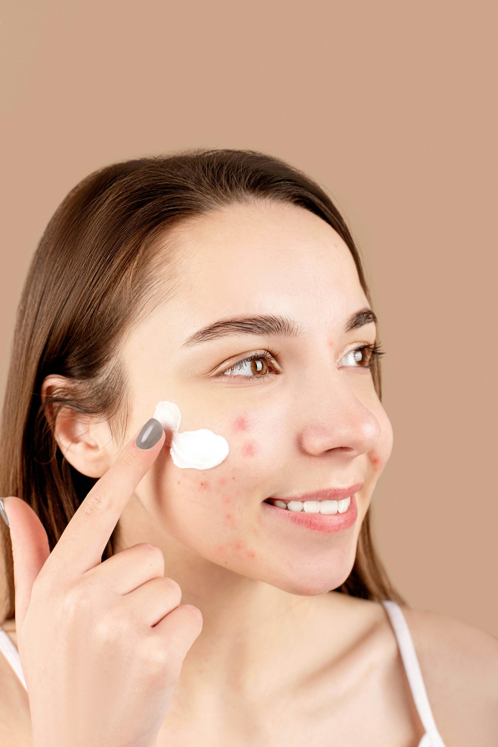 The Ultimate Guide to Pimple Spot Treatments for Sensitive Skin