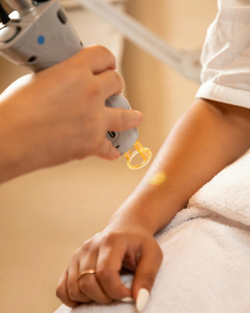hair removal device