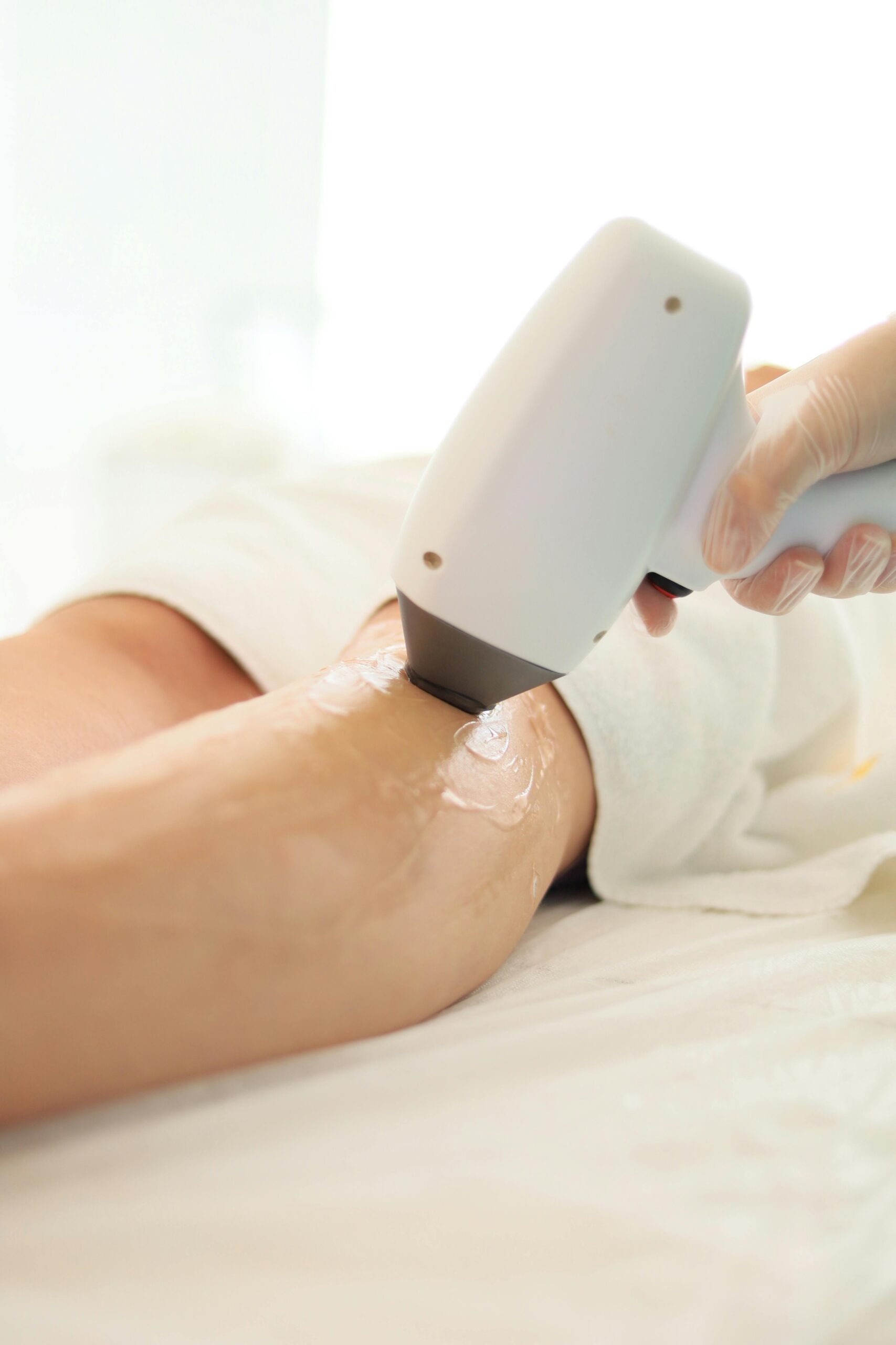 IPL hair removal for women