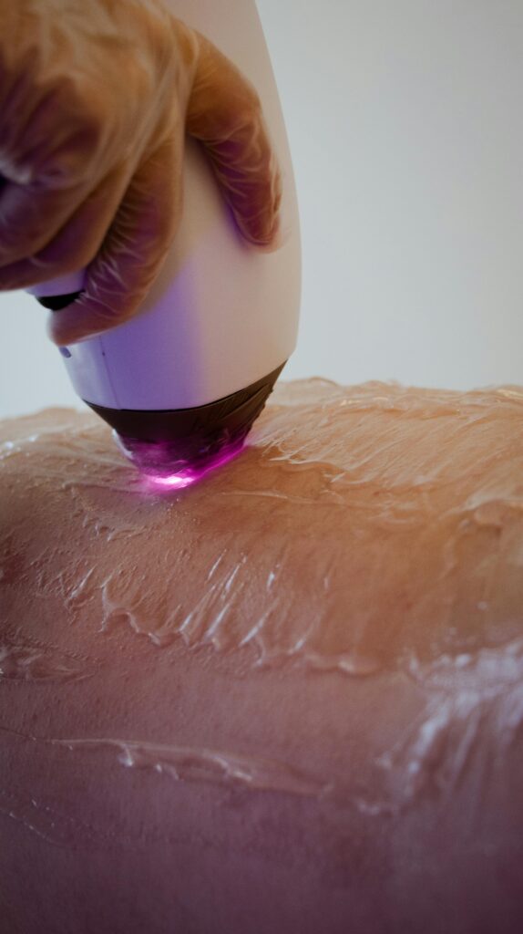 IPL Hair Removal Tips: